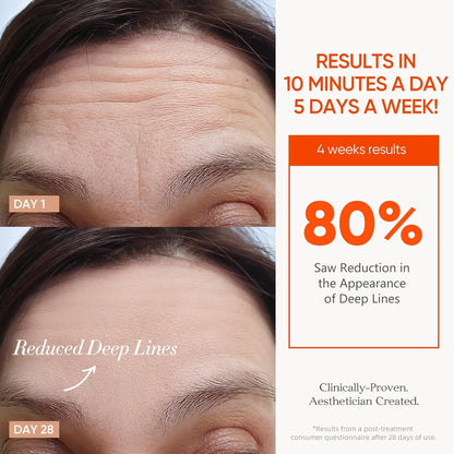 Cordless LED Face Mask for Wrinkle & Acne- Black - MONLANE