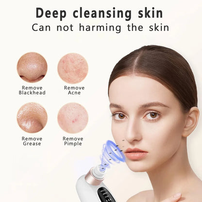 Deep Cleaning Black Head Remover