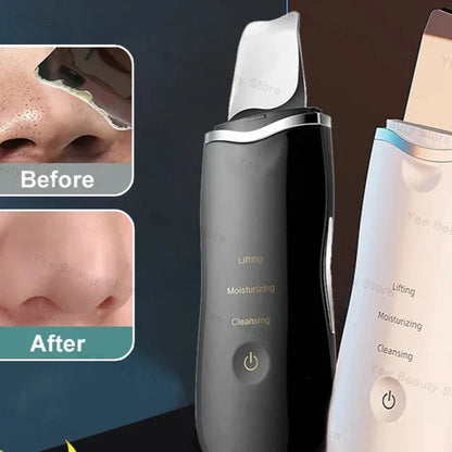 skin Peeling Machine - MONLANE