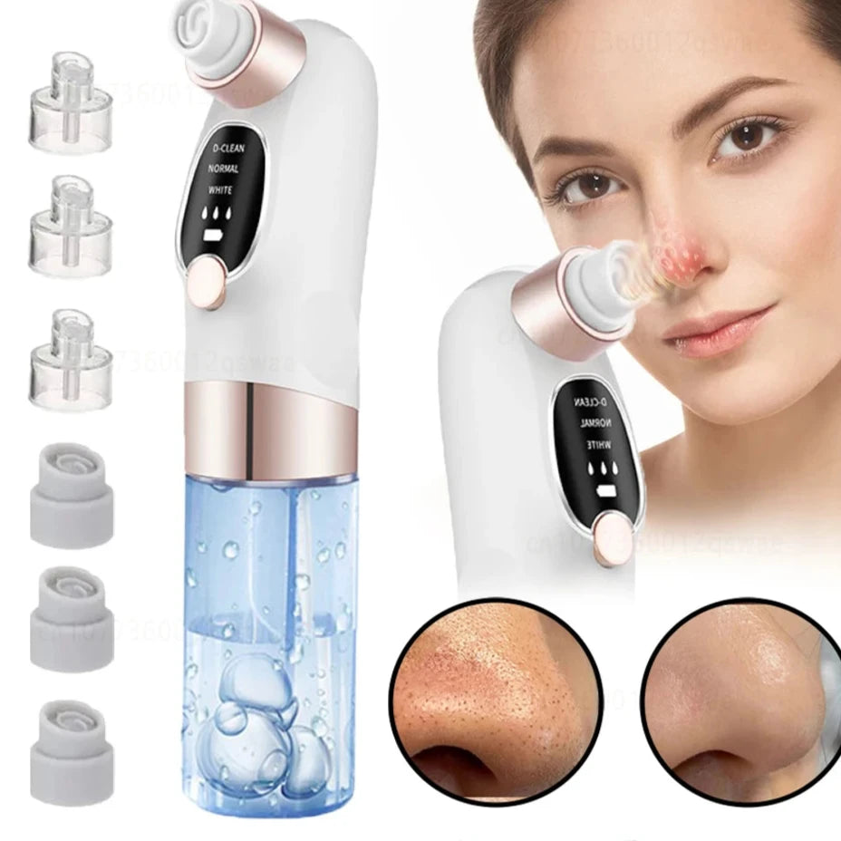 Deep Cleaning  Black Head Remover - MONLANE