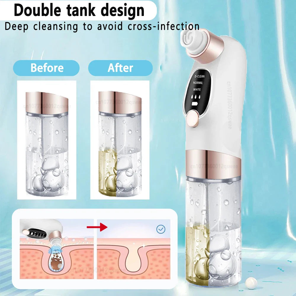 Deep Cleaning Black Head Remover