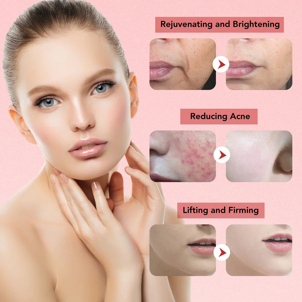 Skin Rejuvenation Facial Massager - MONLANE