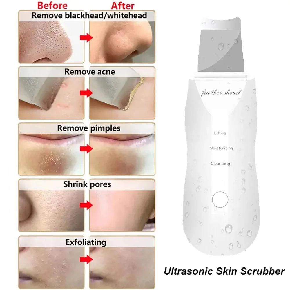 Skin Peeling Machine