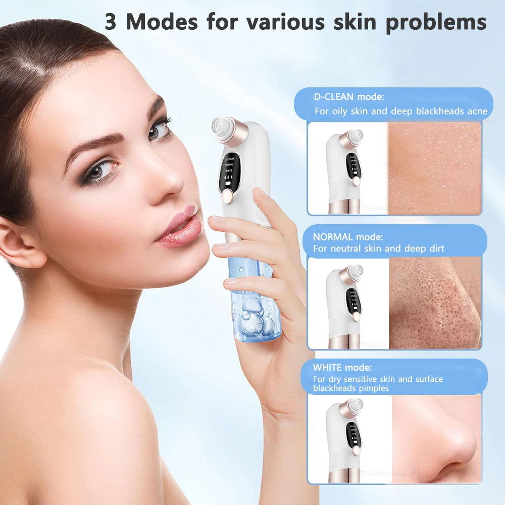 Deep Cleaning  Black Head Remover - MONLANE