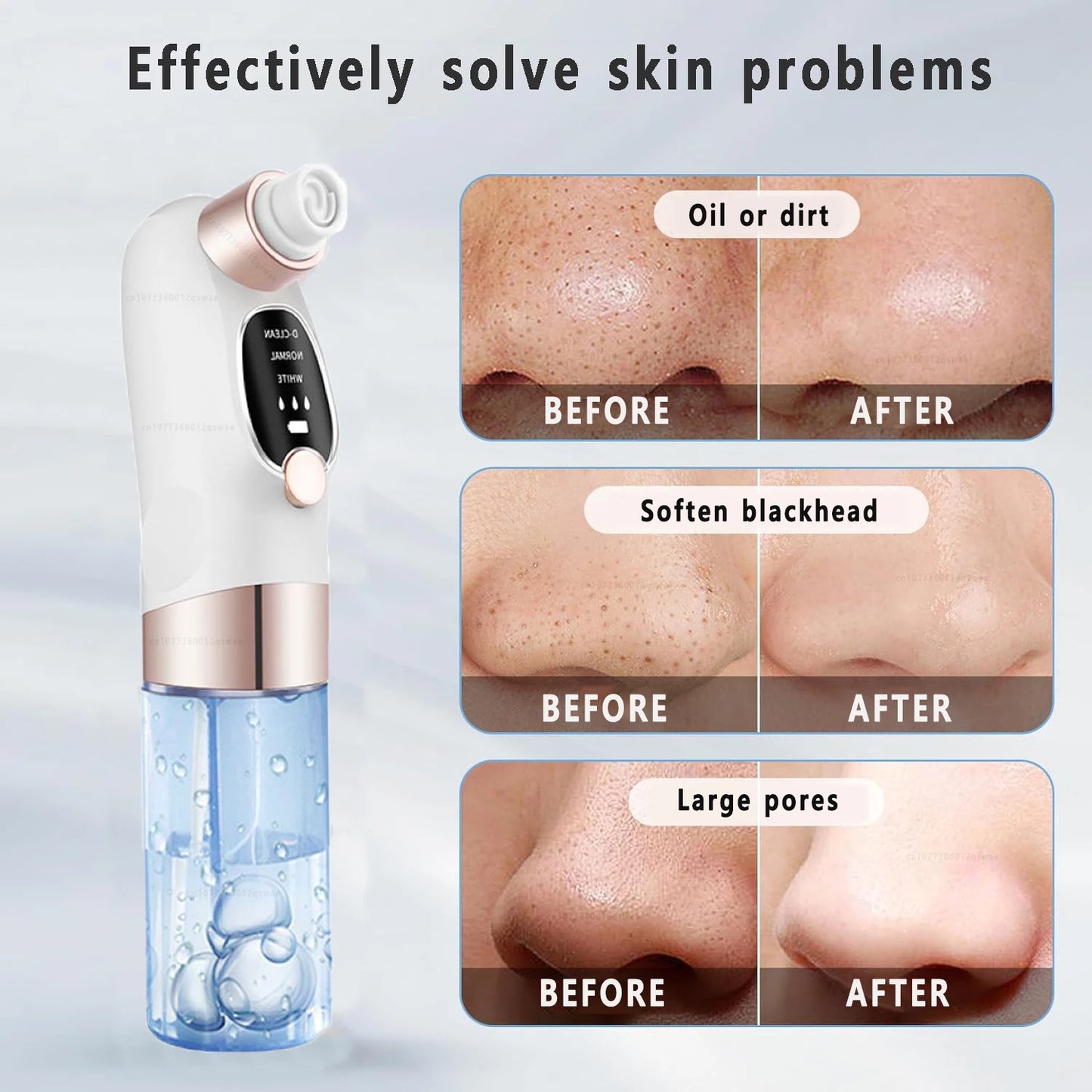 Deep Cleaning  Black Head Remover - MONLANE