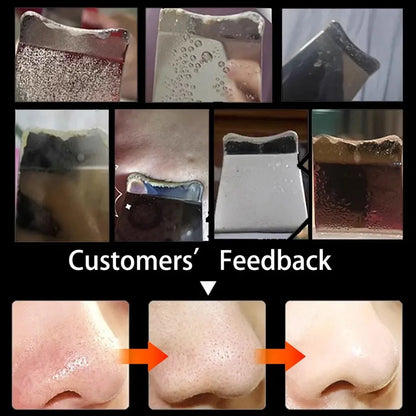 skin Peeling Machine - MONLANE