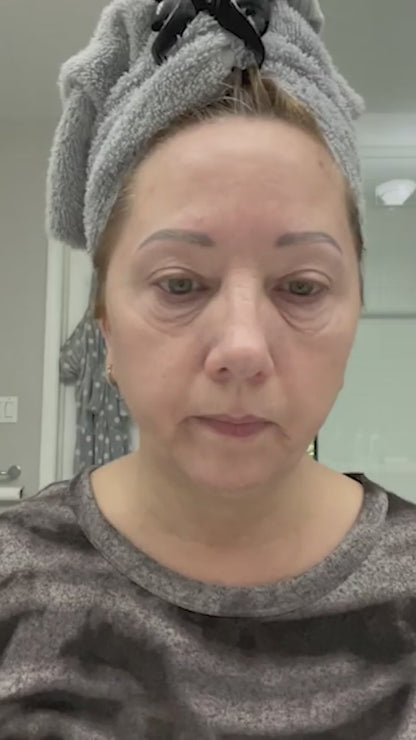 Skin Rejuvenation Facial Massager