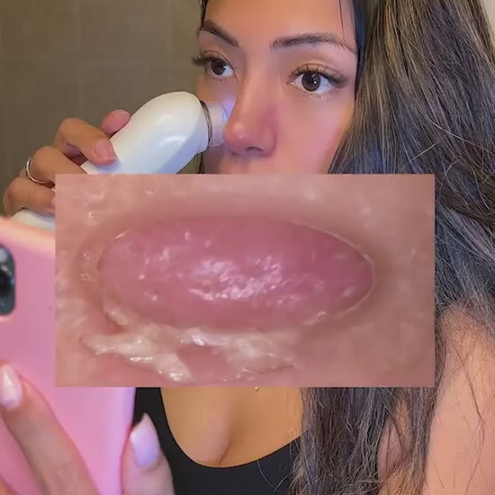 Deep clean black head remover.mp4